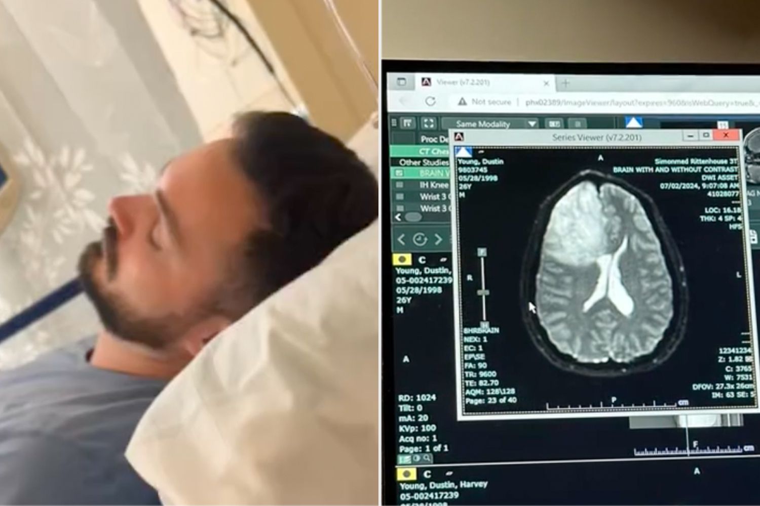 Couple Welcome First Child — Then He Is Diagnosed with Terminal Brain Cancer (Exclusive)