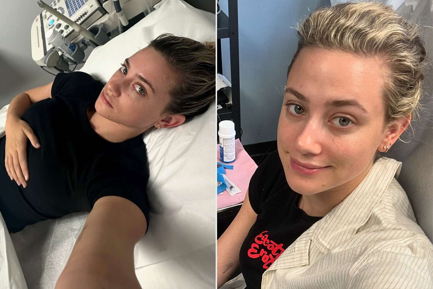 Lili Reinhart Reveals Her 'Mysterious' Chronic Illness