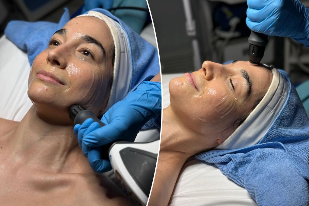I tried SomaCell, a new non-surgical facelift — here's my honest review