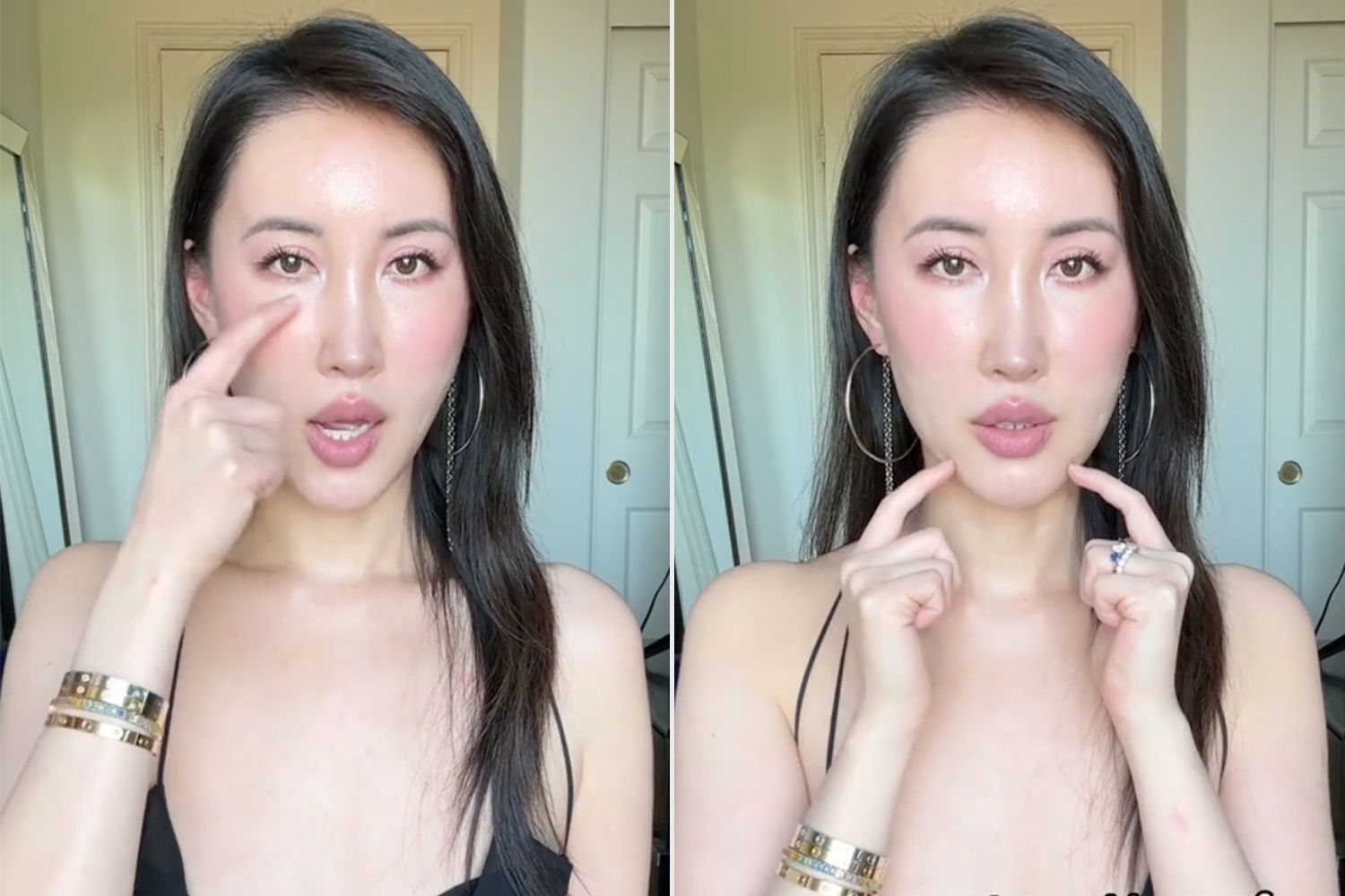 Woman Spent Over $120K on Facial Plastic Surgery. She Rates What She Would and Wouldn't Do Again