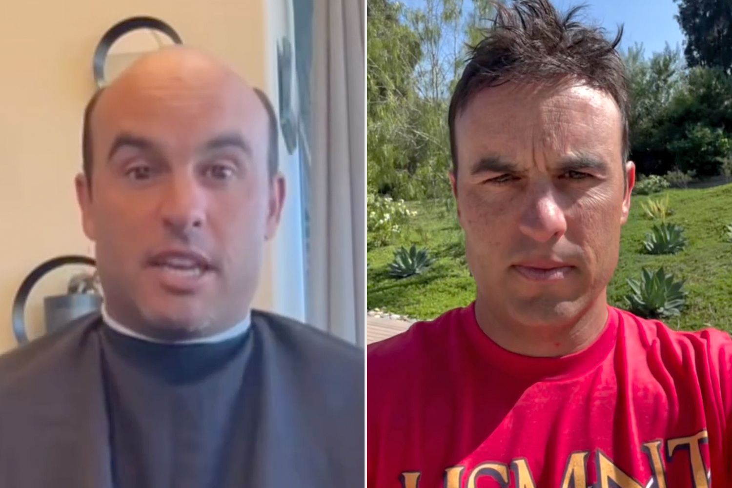 Former Soccer Star Landon Donovan Shows Before And After of Hair Piece Installation