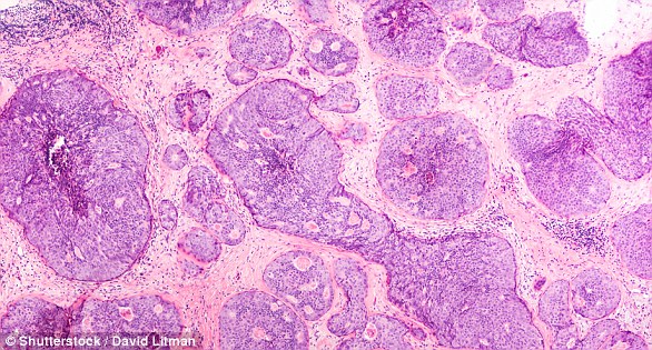 Strictly's Amy Dowden reveals she's undergoing a second mastectomy this week amid breast cancer battle