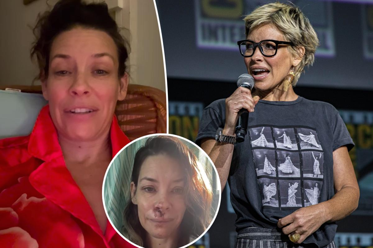 Evangeline Lilly shares that she has brain injury after accident
