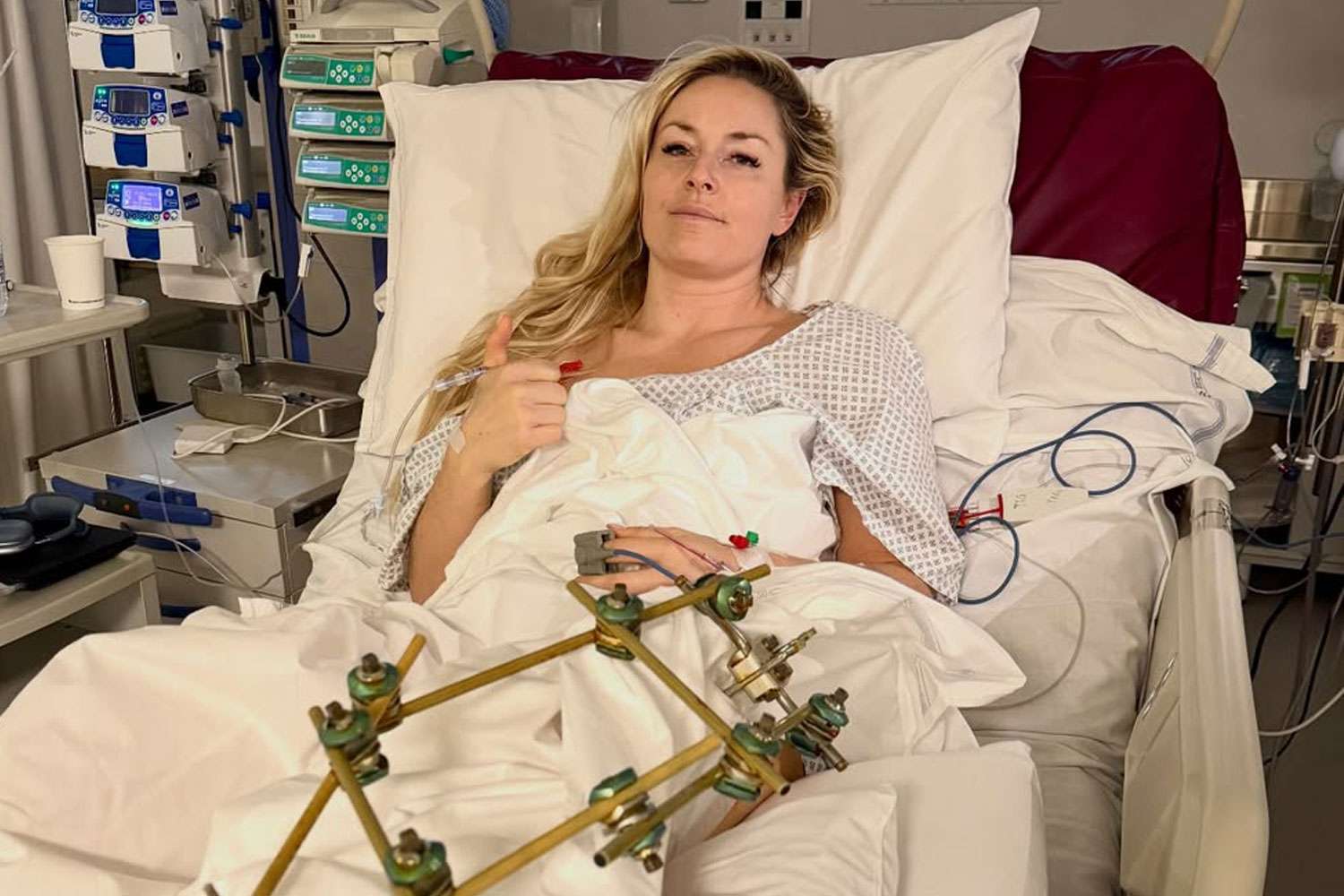 Lindsay Vonn Lindsay Vonn/instagram