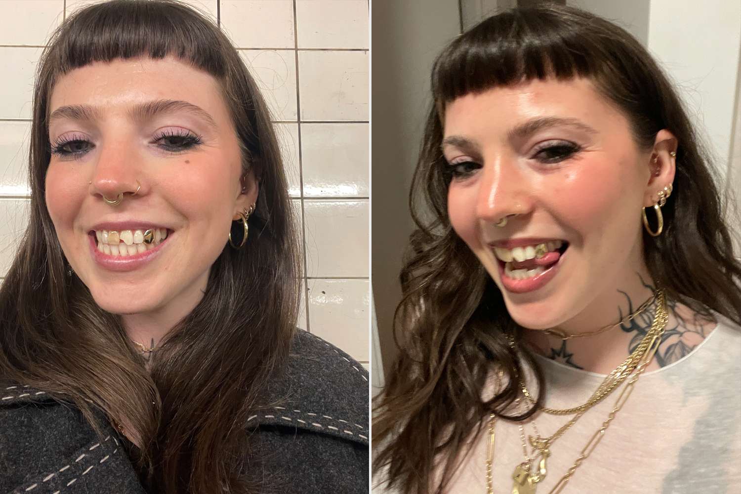 Jessica B after chipping her toothCredit: Jessica B